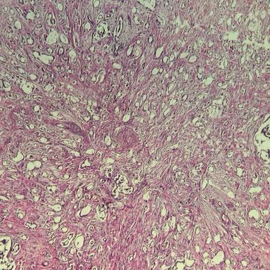 5x magnification sample