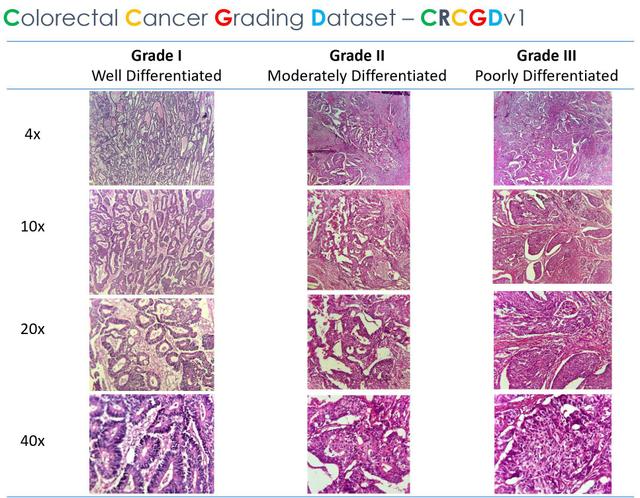 CRC Histopathologic Dataset